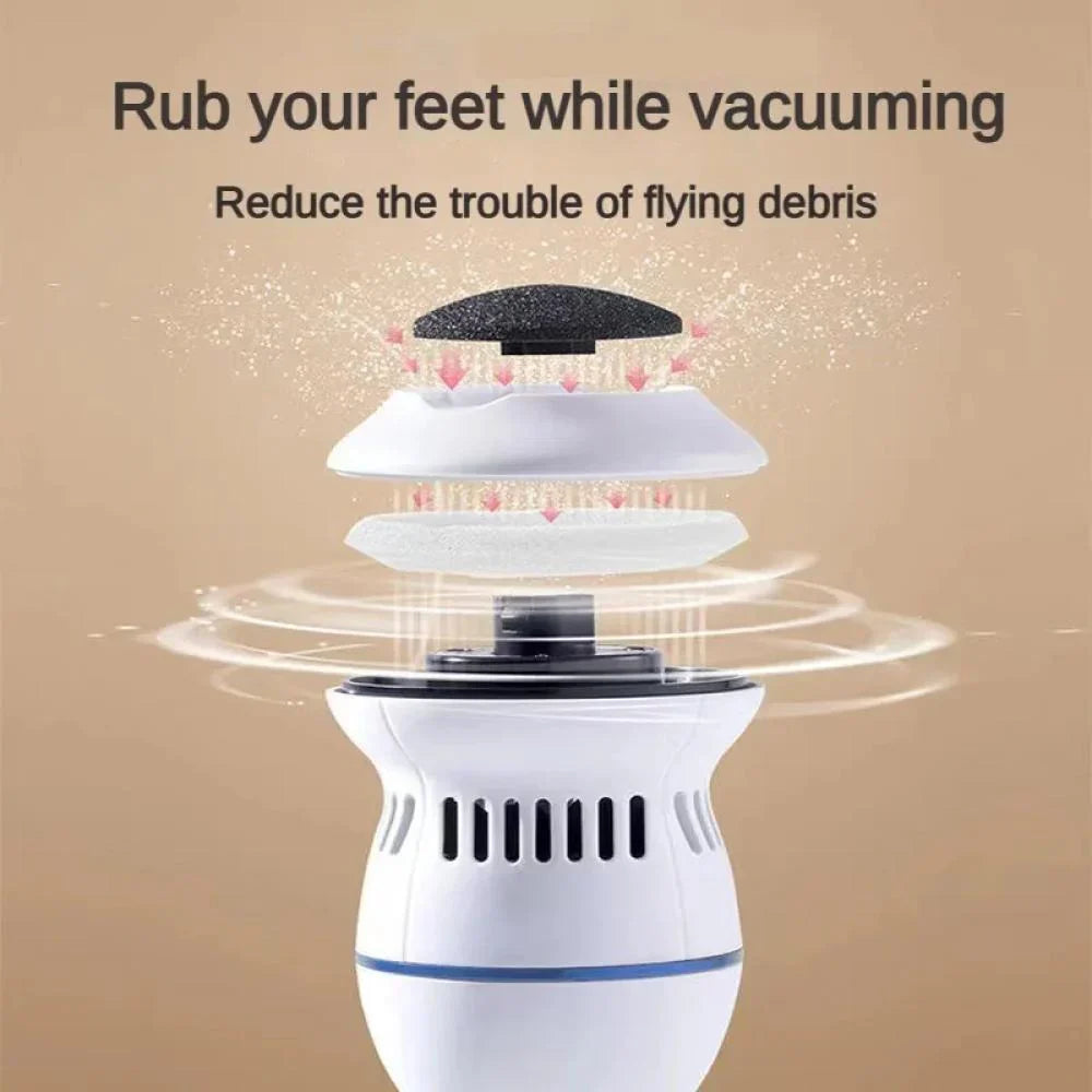 SmoothSole - Electronic Foot Callus Remover