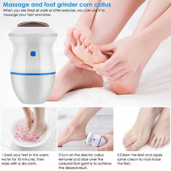 SmoothSole - Electronic Foot Callus Remover