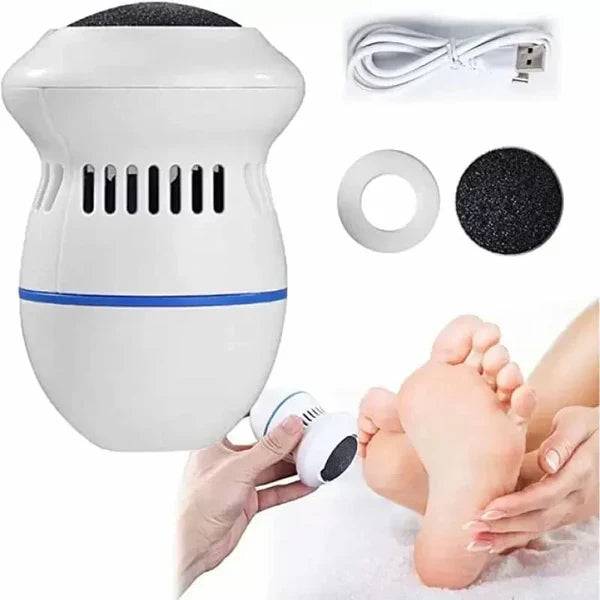 SmoothSole - Electronic Foot Callus Remover