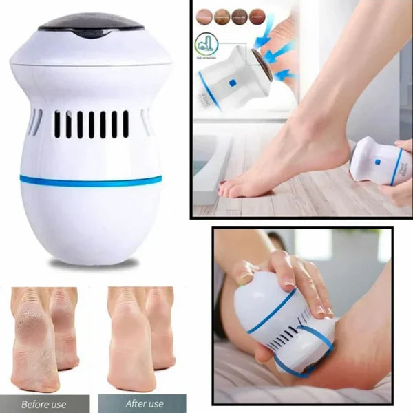 SmoothSole - Electronic Foot Callus Remover