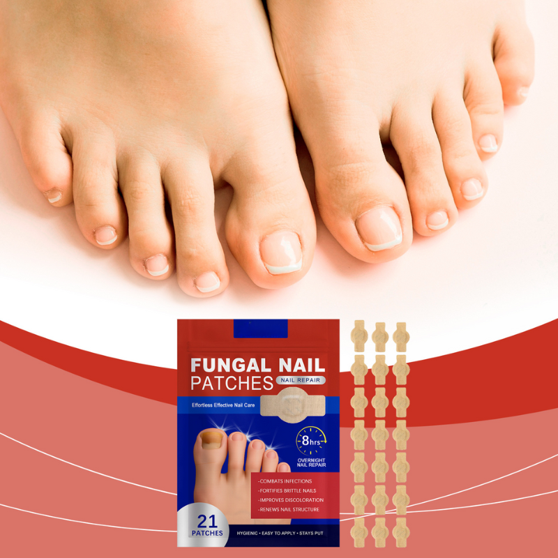FungalPatch - Anti Bacterial Fungal Condition Patch And Nail Care Pack