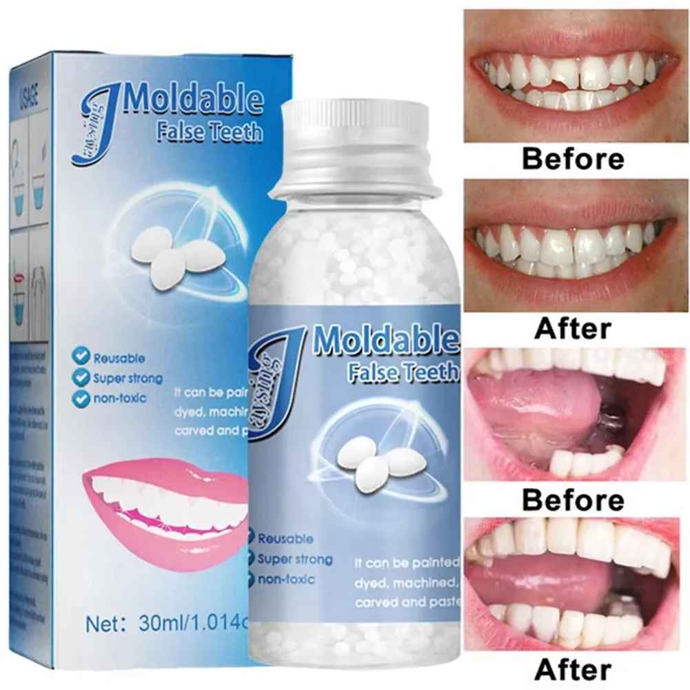TeethRepair™ 1+1 FREE: Natural-Looking Teeth Repair Kit