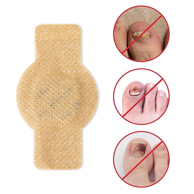 FungalPatch - Anti Bacterial Fungal Condition Patch And Nail Care Pack