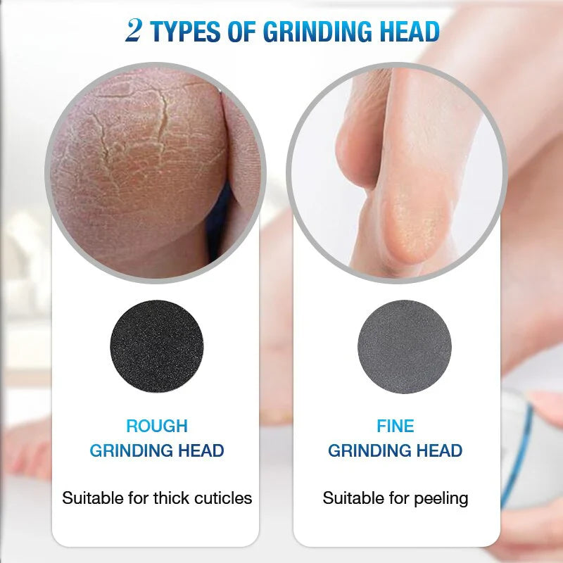 SmoothSole - Electronic Foot Callus Remover