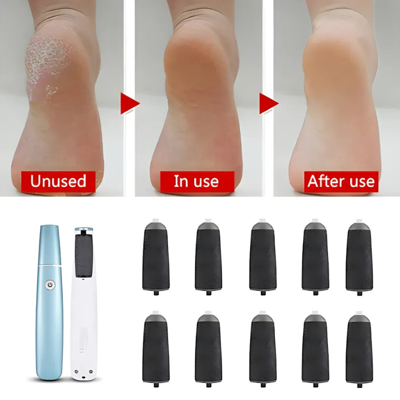 FileGrinder - Foot Grinder Callus Remover File Refill