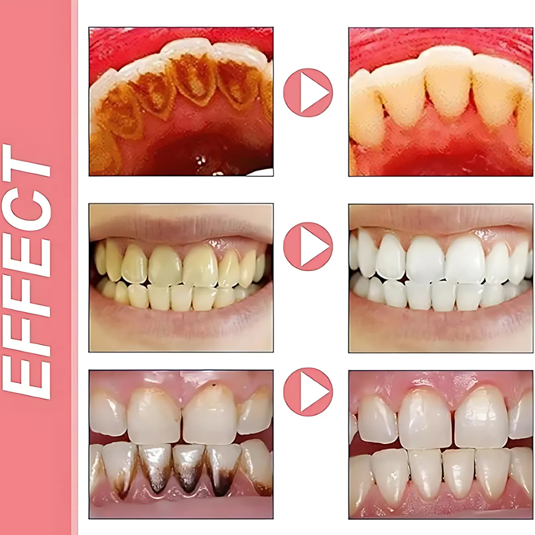 ProbioticToothpaste 1+1 FREE: Gentle Whitening Strengthening Probiotic Toothpaste
