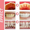 ProbioticToothpaste 1+1 FREE: Gentle Whitening Strengthening Probiotic Toothpaste