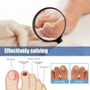 FungalPatch - Anti Bacterial Fungal Condition Patch And Nail Care Pack