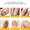 FungalPatch - Anti Bacterial Fungal Condition Patch And Nail Care Pack