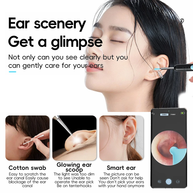EarCamera - HD Ear Camera Kit