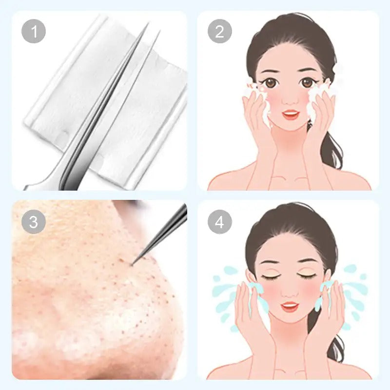 FacialTools - Stainless Steel Blackhead Removal Tool Set