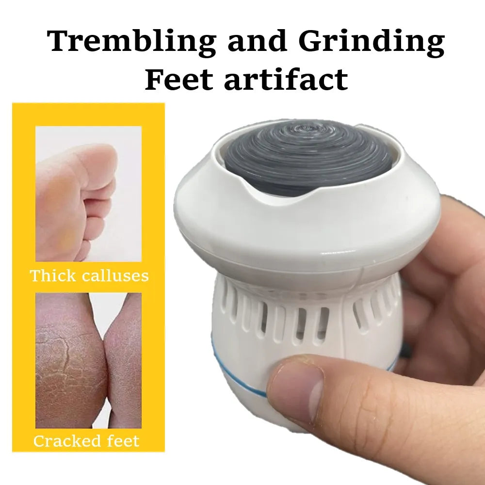 SmoothSole - Electronic Foot Callus Remover