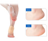 Happy™ HeelProtector 1+1 FREE - Soft Silicone Heel Protector