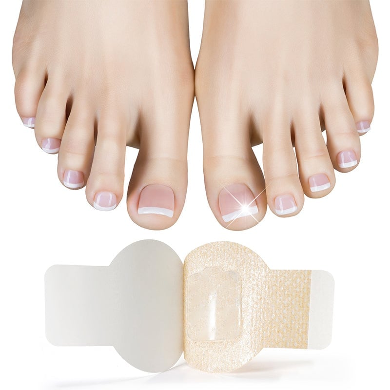 FungalPatch - Anti Bacterial Fungal Condition Patch And Nail Care Pack