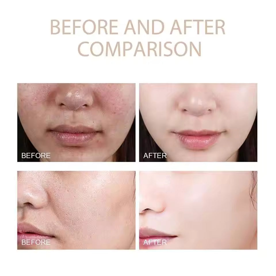 ExfoliatingSerum 1+1 FREE: Easy To Use Soft Exfoliating Ampoule For Sensitive Skin