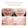 ExfoliatingSerum 1+1 FREE: Easy To Use Soft Exfoliating Ampoule For Sensitive Skin